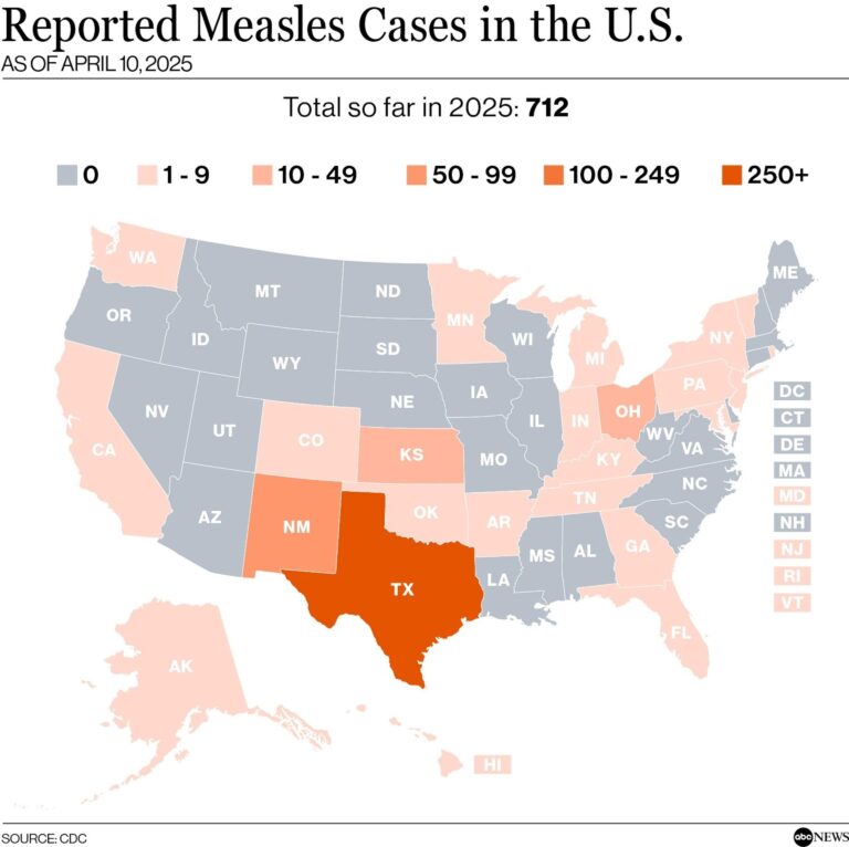 Tracking U.S. Measles Outbreaks – The New York Times