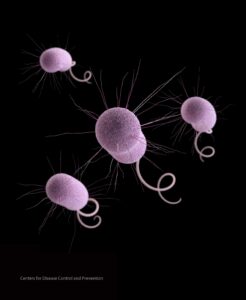 CDC report says ‘nightmare bacteria’ cases are increasing in U.S. – PBS