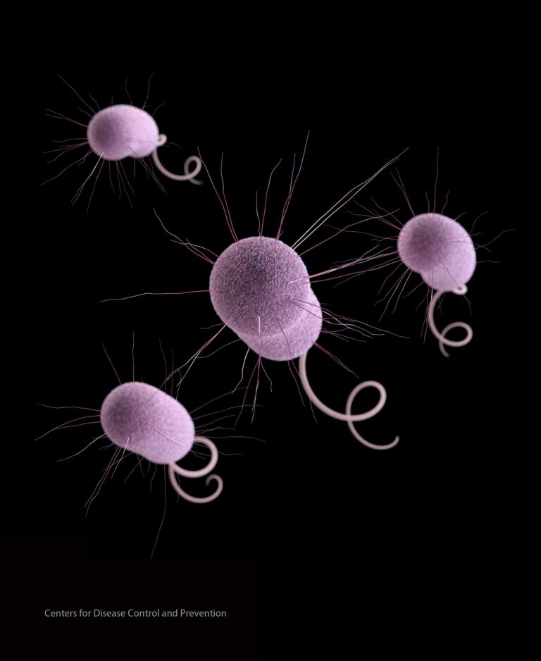 CDC report says ‘nightmare bacteria’ cases are increasing in U.S. – PBS